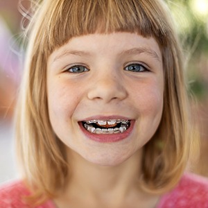 Little girl with orthodontics in pink shirt smiling