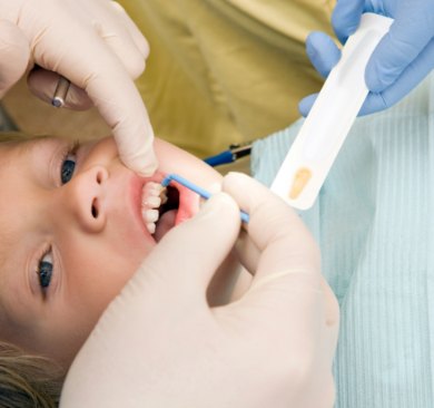 Child receiving a fluoride treatment
